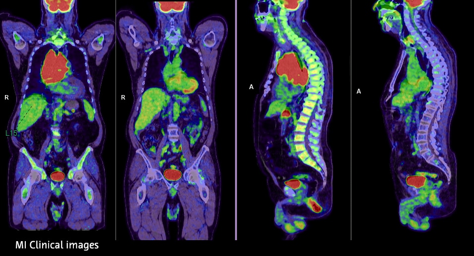 MI-Clinical images