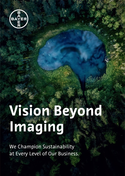 Vision Beyond Imaging