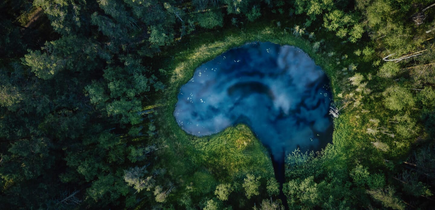 Key Visual Sustainability at Bayer in Radiology – Brain